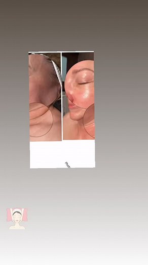 #cherrycreekskincare #spa #esthetician #facialtreatment #massage #Cavicenterskincare | CAVI Center