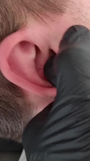 Ear Adjustment and Cracking Bones by Chiropractor