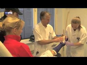 SLC making cast (gips been) by tjh