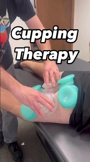 Cupping Therapy for Hamstring Tightness
