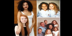 Incroyable : l’une est métisse l’autre est rousse et elles sont jumelles (photos)