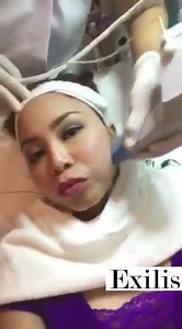 Prepping with Exilis for a V-Contoured face, decreasing unwanted double chin fats while lifting & tightening the skin #vcontour For the first MANILA FASHION BALL Easy Rock Manila radio 💚 | Vine Holistic Medical Aesthetics