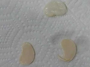 Lima bean seed dissection