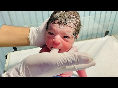 Newborn Baby First Medical Checkup 🩺 | Full Body Examination After Delivery👶 #NewbornExamination