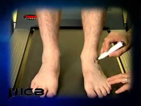 Subtalar Neutral Position - ICB Anterior Alignment Method (AAM)