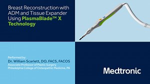 Scarlett: Breast Reconstruction Using ADM, Tissue Expander & PlasmaBlade X Technology