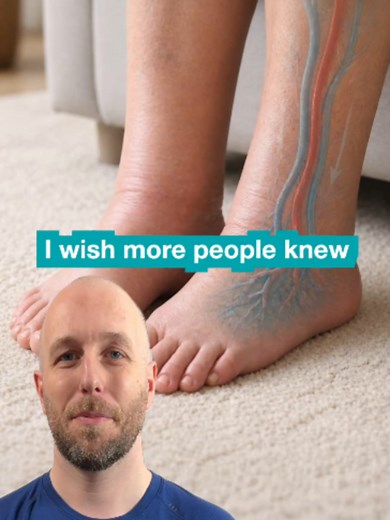 Chair Exercises to Reduce Evening Swollen Ankles