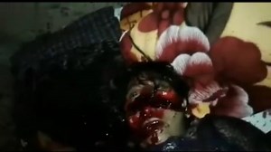 Woman Still Alive After Machete Attack