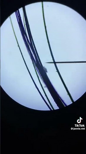 Eyelashes under the microscope 🔬