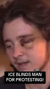 1.6K views · 140 reactions | I.C.E. blinds man for protesting! | The Ghost | Facebook