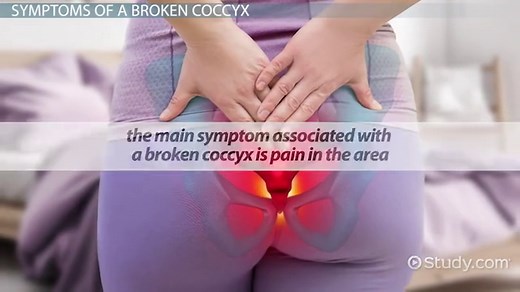 Broken Tailbone | Coccyx Symptoms, Treatment & Recovery Time