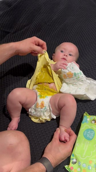 Baby has a very unfortunate poo explosion!