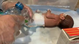 19K views · 232 reactions | Hypothermic Newborn with Skin Rash _ Gentle Care, Peds Cream & Feeding in NICU #newborncare #babyshorts #newborn #babycare | Gautam Ashish | Facebook