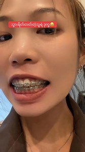 သွားကြီးကကြောက်စရာ ရွံစရာကြီး ထမင်းဘယ်လိုစားလဲ 😂 မသ်ိလ်ို့မေးတာထားပါတော့😂😂🥰 | Nang Bo Lay