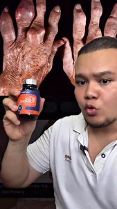 Black tumeric selain curcumin as anti radang, ada lagi 6 jenis bioactive compound yang lain bersifat anti radang. Sakit lutut, sengai2 badan, sakit saraf. Tumeric dari @naturmeric aku recommend. Memang strong scientific and clinical study yg support manfaat black tumeric. #dr1share | Hazwan Drwanshare