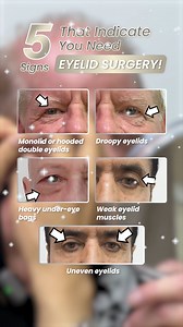 5 Common Eyelid Problems That Might Make You Consider Eyelid Surgery!...