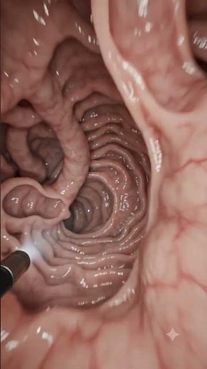 🔍 Endoscopy #mbbs #bds #medicalanimation #anatomy #surgery #medicaleducation #generalsurgery#dental