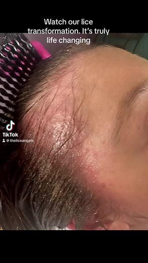 The Lice Angels by: Miranda on TikTok