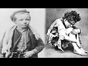 Cruel and Violent Lives of Victorian Orphans (Homeless in 19th Century London)