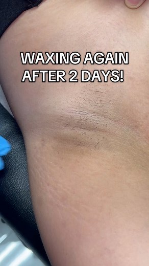 784K views · 10K reactions | Underarm wax with Bushbeads by Bushbalm Professionals 懶懶 This is how you slay a free underarm! #fyp #esthetician #foryoupage #underarmwax #wax #reelsvideo #fblifestyle #waxing #viralvideo | Waxing Queen | Facebook