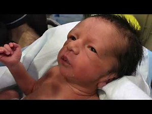 Adorable Premature Baby Feeding 🍼 Happy to Eat 💖 #CuteBaby #Preemie