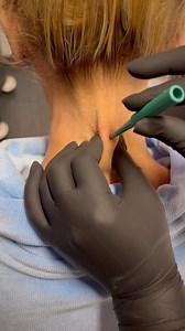 66K views · 436 reactions | • Nape dermal piercing • by @piercedbyamy BOOK NOW ▾ Link in bio! ▾ @undergroundtattoos ⠀ Walk-ins available Cash only It’s not a Piercing unless it’s Underground! ⠀ #dermalpiercing #dermalanchor #neckpiercing #neckdermal #napepiercing #dermal #piercings #piercing #londonpiercer #londonpiercing #piercingideas #piercingaddict #piercinglondon #piercingvideo | Underground Tattoos Watford | Facebook