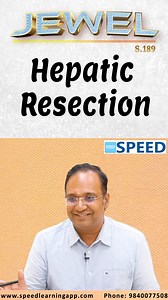 喙 What Determines Post-Op Success After Hepatic Resection?  Dr. K....