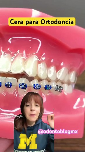 Cera para Ortodoncia #brackets #ortodoncia #ceraparabrackets | Odontoblog