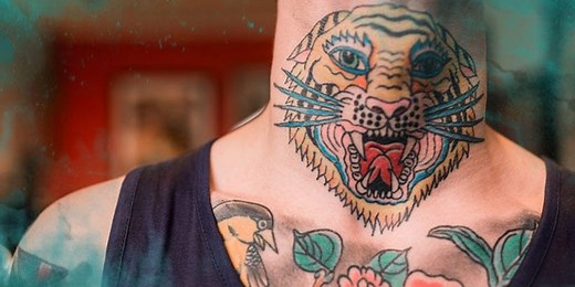 What to Know About Color Tattoo Removal
