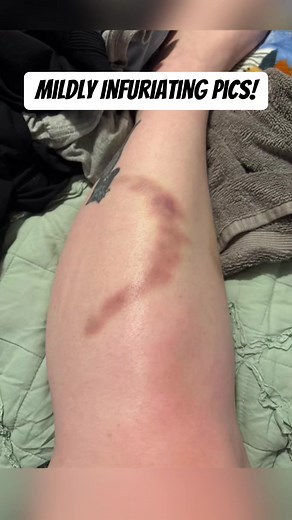 #mildlyinfuriating #mildlyinteresting #rarephotos | pics