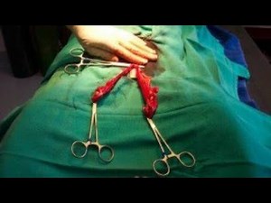 Female dog spaying procedure.