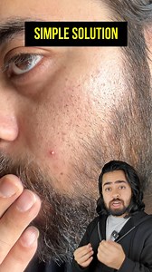 8.6K views · 127 reactions | Bade bade actors, influencers aur...