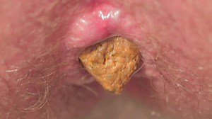 Close-up Poop HD Original