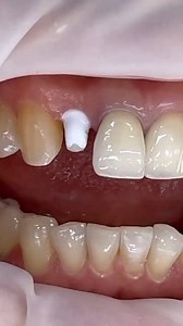 dentistry #dentistry | W dental