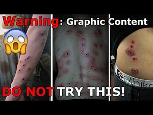 Worst Airsoft Injury Ever! BLEEDSOFT *NO Rules Airsoft* DO NOT TRY THIS!