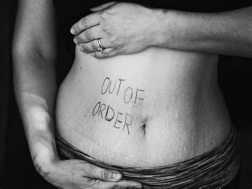 Chronic Cholecystitis: Causes, Symptoms, Treatment, and Prevention