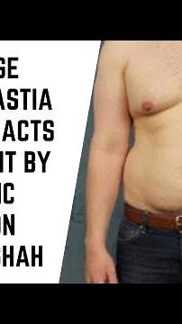 Teenage Gynecomastia Medical facts and Treatment options explained by Plastic Surgeon Dr Arth Shah