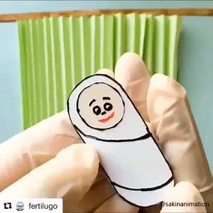 4.1K views · 256 reactions | Cesarean Section #CS | General Nursing Students | Facebook