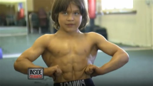 “Little Hercules” Then and Now: The Incredible Transformation of Richard Sandrak