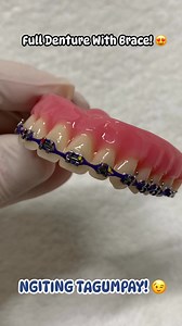 341K views · 2.8K reactions | #NgitingTagumpay#MakeOver#RiyadhKSA | Denture Denture | Facebook