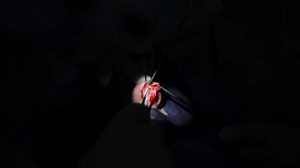 Functional Rhinosurgery Restoration Nasal Breathing Alignment Septum Rhinoplasty Surgeons Work