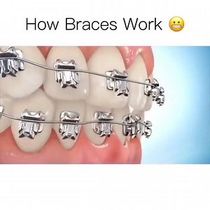 Aesthetic Dentistry on Reels