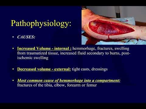 Compartment syndrome 1 - pathophysiology (OTA lecture series III g04a)