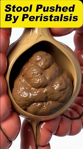 Stool Pushed by Peristalsis 3D Animation