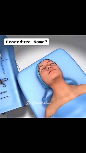 17K views · 167 reactions | DM for Paid Promotion. . ....