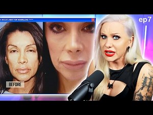 She got a Lip Transplant to fix Botched filler. (Dr. 90210) | Luxeria