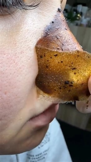 Glow Tips | @glow.tulip Your Skin Deserves This Honey Glow! 🍯 Peel away dirt, oil, and impurities in minutes! Our Honey Tearing Mask deeply cleanses,... | Instagram