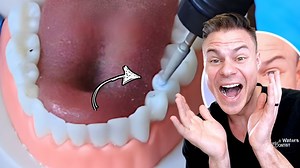 From filing teeth to DIY retainers—some of these brace hacks are just too much #DentalTips #OrthoLife #DentalComedy #BracesOff | TheBentistofficial