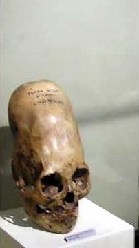 The Sleeping Lady: Human Depictions in Malta's Neolithic