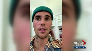 Alberta lifts remaining COVID restrictions & How Justin Bieber is shining a spotlight on the shingles vaccine